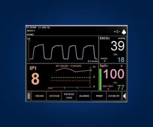 Smart Capnography™ Algorithms - Microstream™ Technology