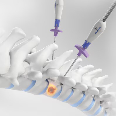 OsteoCool™ RF ablation system