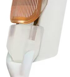 Barrx™ 60 RFA focal catheter